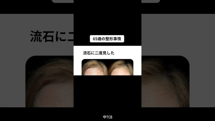 【クマ取り】シニアも整形の時代⁉️#shorts