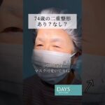 【二重整形】シニアの二重整形に密着！#sgorts