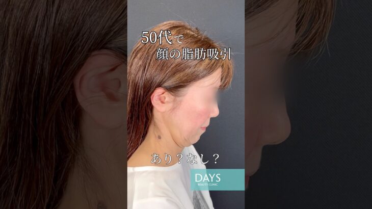 【小顔整形】シニアの小顔整形もお任せください！#shorts