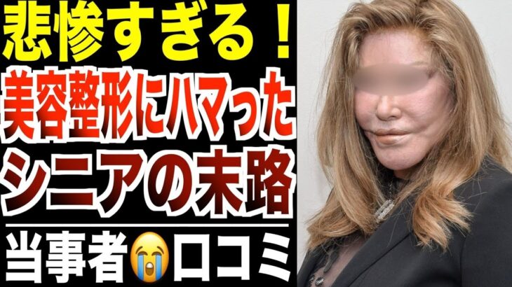 【悲惨すぎる】美容整形に依存したシニア女性たちの実体験！口コミ30選紹介します。