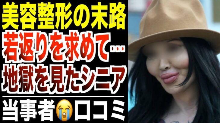 【美容整形の末路】若返りを求めて地獄を見たシニア！口コミ30選紹介します【パート3】