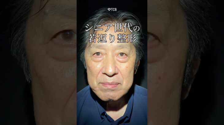シニア世代の若返り整形👀 #shorts